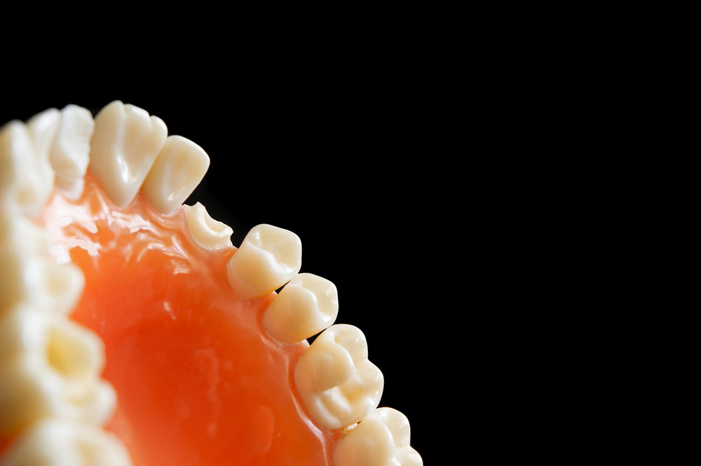 Image de dents
