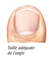Taille adéquate de l'ongle