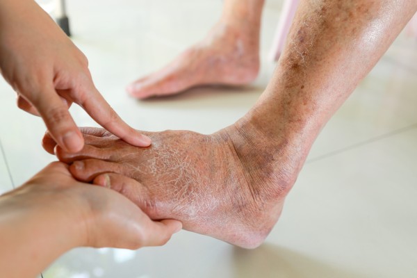 Prendre soin de vos pieds